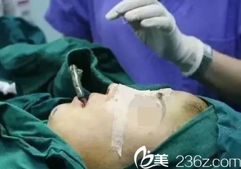 鼻綜合隆鼻手術(shù)之縫合過程