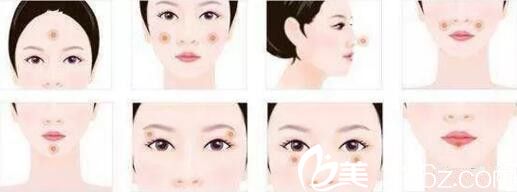 自體脂肪填充全臉部位介紹