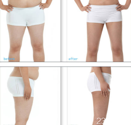 吸脂瘦身前后對(duì)比圖