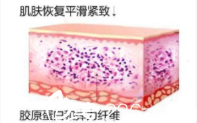 皮膚結(jié)構(gòu)示意圖