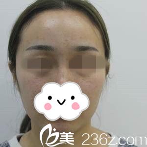 手術(shù)前的我 手術(shù)前的我