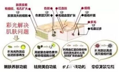 彩光嫩膚祛斑功效的介紹