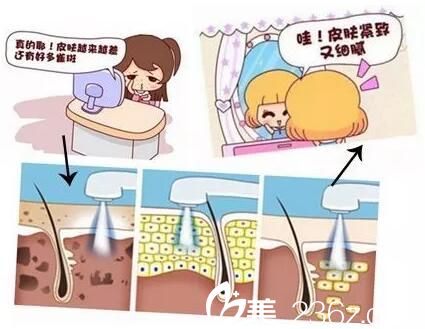 光子嫩膚改善效果對(duì)比