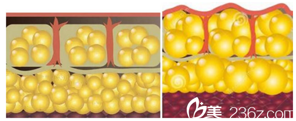 和正常脂肪細(xì)胞相比變大的細(xì)胞