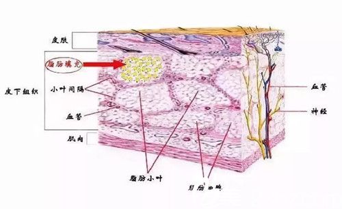 自體脂肪填充構(gòu)成