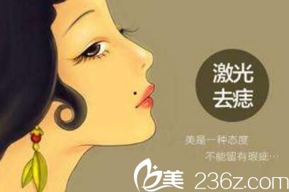 激光祛痣的效果優(yōu)勢及價(jià)格