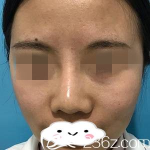 手術(shù)前的我 手術(shù)前的我