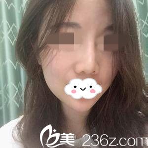 手術(shù)半個(gè)月后 手術(shù)半個(gè)月后