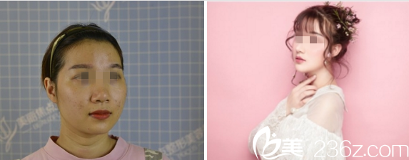 20180917_1537177814667623.png image.png