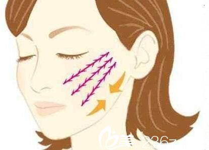 面部線雕 面部線雕