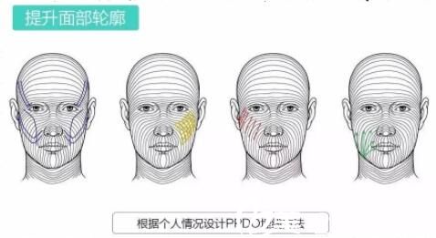 面部線雕原理 面部線雕原理