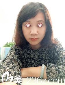 我54了，不夸張的說這回在貴陽美貝爾整形醫(yī)院做完埋線提升看著像30多！