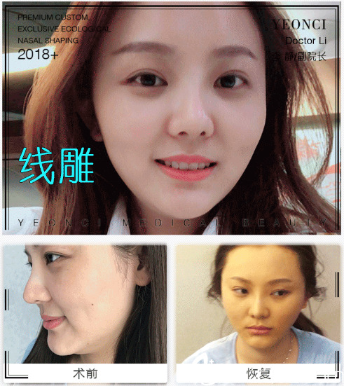 深圳妍熙李靜做的面部<span style=