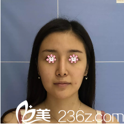 術(shù)前我的皮膚有點(diǎn)下垂 術(shù)前我的皮膚有點(diǎn)下垂