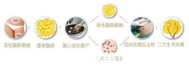 自體脂肪隆胸抽取脂肪全過(guò)程