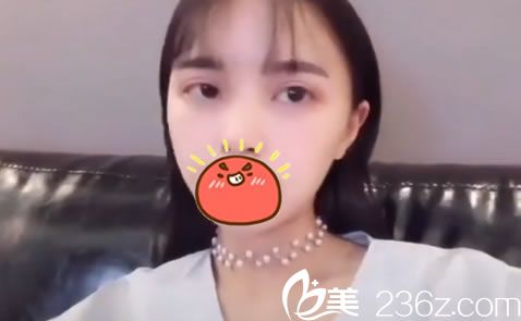 做完雙眼皮手術(shù)19天恢復(fù)照