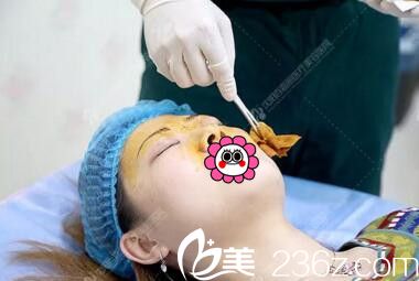 注射隆鼻術前消毒