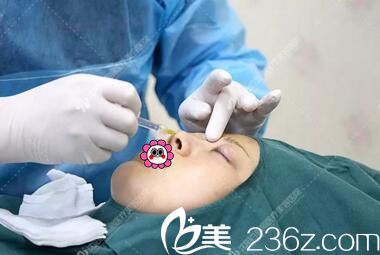 玻尿酸隆鼻手術過程中