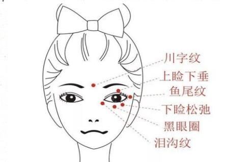 面部有那些皺紋問題