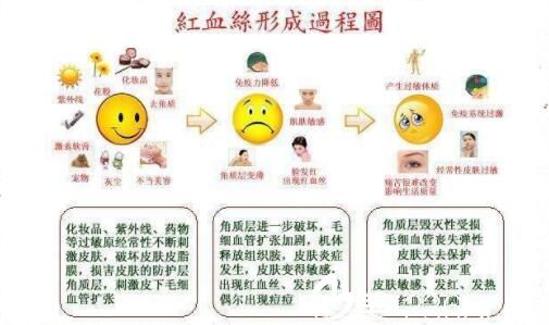 紅血絲形成的原因