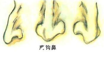 鷹鉤鼻的形狀