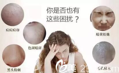 皮膚經(jīng)常存在的幾大問(wèn)題