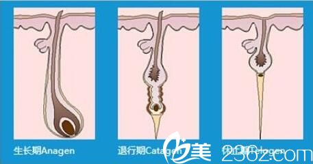 超冰的脫毛原理