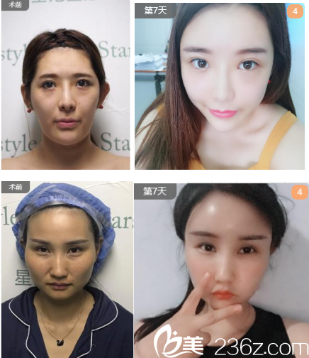 <!--<i data=20240703-sp></i>-->醫(yī)療美容診所線雕案例分享 <!--<i data=20240703-sp></i>-->醫(yī)療美容診所線雕案例分享