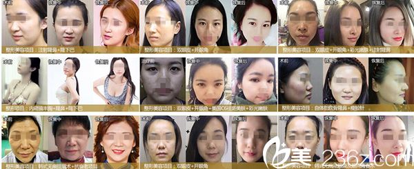 宜昌前衛(wèi)整形案例合集