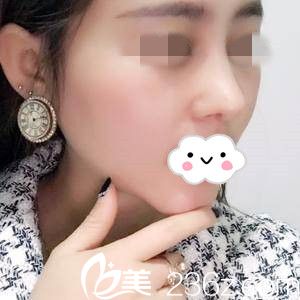 術(shù)后一周 術(shù)后一周