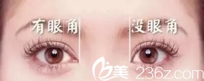 開眼角與沒開眼角的區(qū)別 開眼角與沒開眼角的區(qū)別