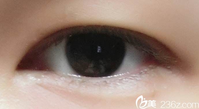 內(nèi)雙也有自己的煩惱