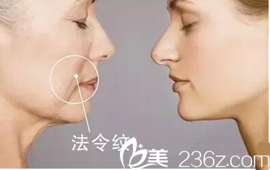 皮膚老化松弛 皮膚老化松弛