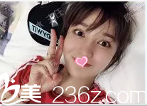 在北京聯(lián)合麗格做弦性面部提升第7天效果 在北京聯(lián)合麗格做弦性面部提升第7天效果