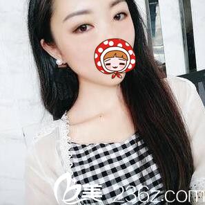 直播我在整形醫(yī)院做內(nèi)切祛眼袋全過程及術(shù)后一周恢復(fù)效果！