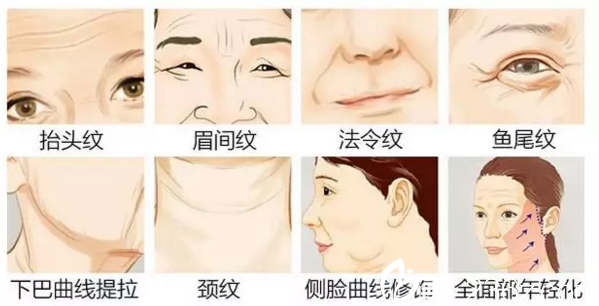 線雕能解決的問題