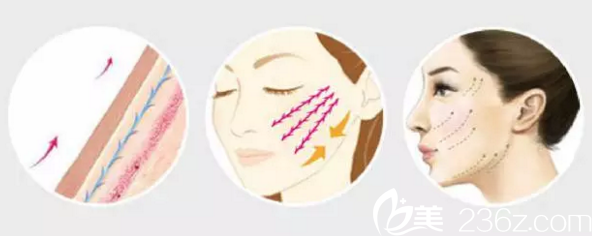 衡陽美萊線雕效果展示