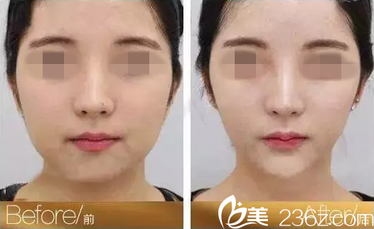 衡陽美萊線雕提拉真人案例