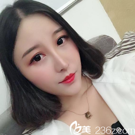 公開我找深圳軍科整形醫(yī)院劉月更做膨體耳軟骨鼻綜合隆鼻子的心路歷程