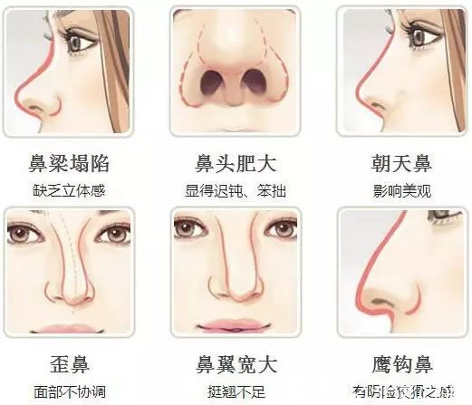 常見的鼻部缺陷問題示意圖