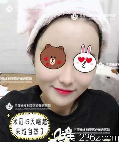 做自體脂肪面部填充術(shù)后半個(gè)月恢復(fù)<span style= 做自體脂肪面部填充術(shù)后半個(gè)月恢復(fù)<span style=
