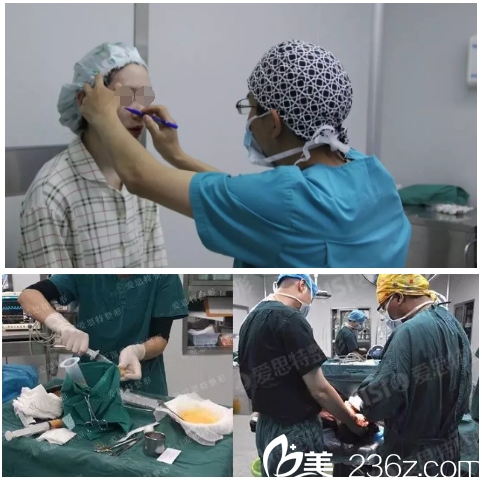 自體脂肪填充手術(shù)中 自體脂肪填充手術(shù)中