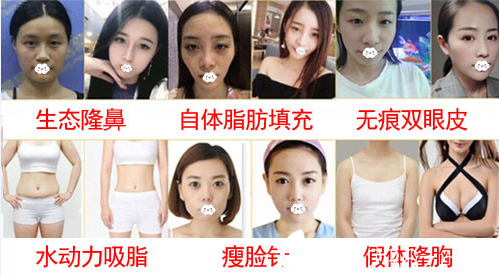 淮北東方美萊塢(伊爾美)醫(yī)療美容醫(yī)院雙眼皮、隆鼻、隆胸案例