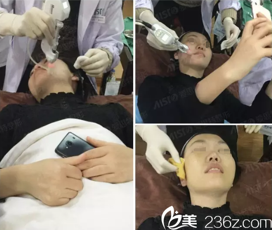 水光注射過程 水光注射過程