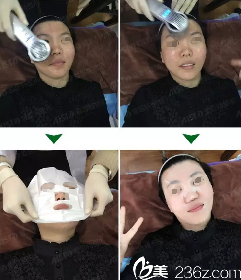 術(shù)后的鎮(zhèn)痛管理敷醫(yī)用面膜 術(shù)后的鎮(zhèn)痛管理敷醫(yī)用面膜