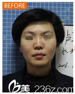 術(shù)前皮膚暗沉發(fā)黃 術(shù)前皮膚暗沉發(fā)黃