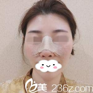 手術(shù)后第3天