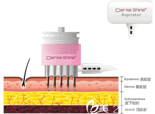 南寧韓星注射 南寧韓星注射