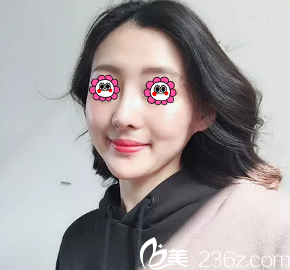 我慕名找北京葉子魯禮新做鼻子花近七萬這假體鼻綜合效果你喜歡么