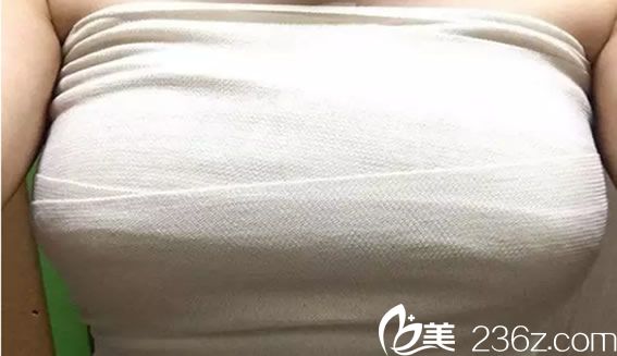 來福琳隆胸手術(shù)第3天 來福琳隆胸手術(shù)第3天